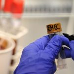 Ehec-Ausbruch in MV: Zwei neue Ehec-Fälle – CDU für Polizei bei Suche nach Quelle